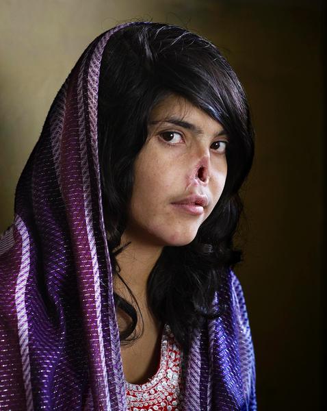 Bibi Aisha, disfigured as punishment for fleeing her husband's house, Kabul, Afghanistan